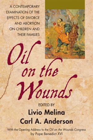 Book cover of Oil on the Wounds