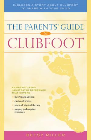 Cover of the book The Parents' Guide to Clubfoot by Thomas Bien, Ph.D., Beverly Bien, M. Ed.