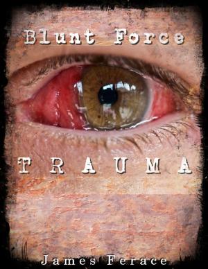 Cover of the book Blunt Force Trauma by Maurice Vahedifar, D.M.D., M.S.