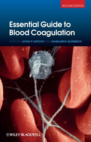 Cover of the book Essential Guide to Blood Coagulation by Bruce Mackenzie, Allan Lombard, Danie Coetsee, Tapiwa Njikizana, Raymond Chamboko