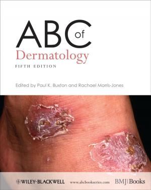 Cover of the book ABC of Dermatology by Eben Upton, Gareth Halfacree