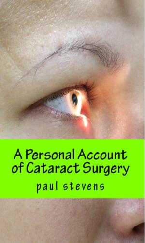 Cover of A Personal Account of Cataract Surgery