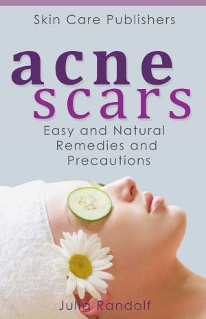 Cover of the book Acne Scars: Easy and Natural Remedies and Precautions by Camille Heimbrod