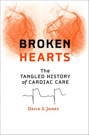Cover of the book Broken Hearts by Russell F. Reidinger Jr., James E. Miller