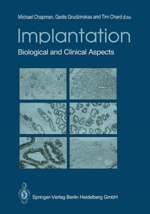 Cover of the book Implantation by Casper Harteveld