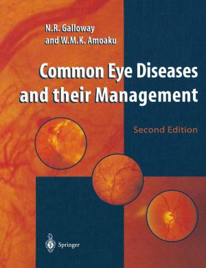 Cover of the book Common Eye Diseases and their Management by Yong Yin, JianMing Zhu, Ikou Kaku, Jiafu Tang