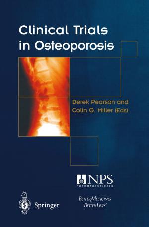 Cover of the book Clinical Trials in Osteoporosis by Freddy Rafael Garces, Victor Manuel Becerra, Chandrasekhar Kambhampati, Kevin Warwick