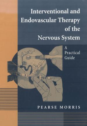 Cover of the book Interventional and Endovascular Therapy of the Nervous System by Peter R. Bergethon, Kevin Hallock
