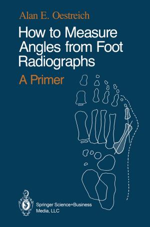 Cover of the book How to Measure Angles from Foot Radiographs by Robert Upson, Kathy A. Notarianni