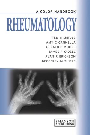 Cover of the book Rheumatology by Yukio Yanagisawa, Hiroshi Yoshino, Satoshi Ishikawa, Mikio Miyata