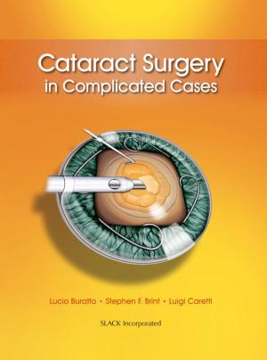 bigCover of the book Cataract Surgery in Complicated Cases by 