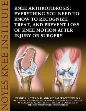 Cover of Knee Arthrofibrosis: Everything You Need to Know to Recognize, Treat, and Prevent Loss of Knee Motion After Injury or Surgery