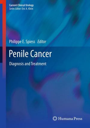 Cover of the book Penile Cancer by Jerome Goddard