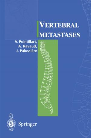 Cover of the book Vertebral metastases by Francis Hartmann, Gérard Cucchi