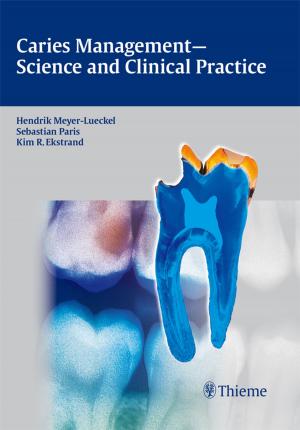 Cover of the book Caries Management - Science and Clinical Practice by 