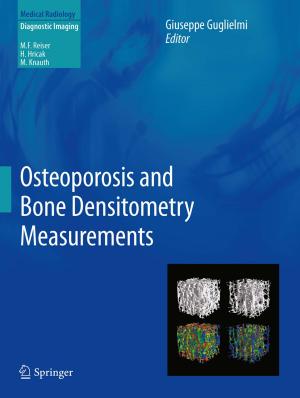 Cover of the book Osteoporosis and Bone Densitometry Measurements by Michaeleen Doucleff, Mary Hatcher-Skeers, Nicole J. Crane