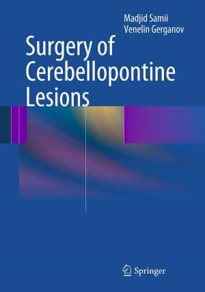 Cover of the book Surgery of Cerebellopontine Lesions by Dov M. Gabbay, Karl Schlechta