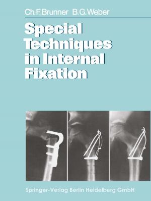 Cover of the book Special Techniques in Internal Fixation by Zhong-Ke Gao, Ning-De Jin, Wen-Xu Wang
