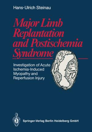 Cover of the book Major Limb Replantation and Postischemia Syndrome by Bernd Spangenberg, Christel Weins