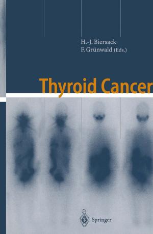 Cover of the book Thyroid Cancer by Dieter Schramm, Manfred Hiller, Roberto Bardini