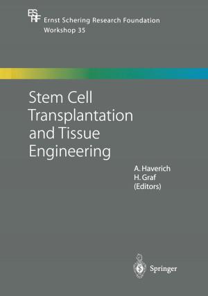 Cover of the book Stem Cell Transplantation and Tissue Engineering by B.J. Addis, M.S. Bains, M.E. Burt, P. Goldstraw, H.H. Hansen, F.R. Hirsch, M.E. Hodson, L.R. Kaiser, N. Martini, P.M. McCormack, A.H. Pomerantz, M. Rorth, R. Souhami, S.G. Spiro, J.S. Tobias, T. Treasure, J.R. Yarnold