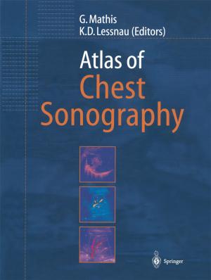 Cover of the book Atlas of Chest Sonography by Jasna Mihailovic, Stanley J. Goldsmith, Ronan P. Killeen