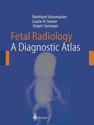 bigCover of the book Fetal Radiology by 