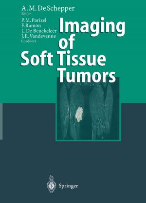 Cover of the book Imaging of Soft Tissue Tumors by G.E. Burch, L.S. Chung, R.L. DeJoseph, J.E. Doherty, D.J.W. Escher, S.M. Fox, T. Giles, R. Gottlieb, A.D. Hagan, W.D. Johnson, R.I. Levy, M. Luxton, M.T. Monroe, L.A. Papa, T. Peter, L. Pordy, B.M. Rifkind, W.C. Roberts, A. Rosenthal, N. Ruggiero, R.T. Shore, G. Sloman, C.L. Weisberger, D.P. Zipes