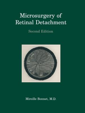 Cover of the book Microsurgery of Retinal Detachment by Achintya Kumar Pramanick