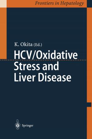Cover of the book HCV/Oxidative Stress and Liver Disease by Hiroshi Iwata, Kunio Shimada