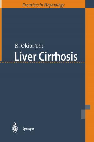 Cover of the book Liver Cirrhosis by Yukiko Senda