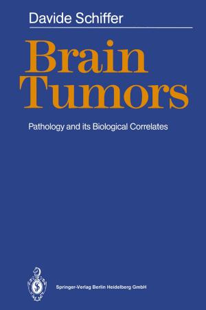 Cover of the book Brain Tumors by M. Abate, F. Tovena