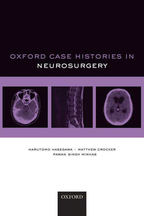 Cover of the book Oxford Case Histories in Neurosurgery by Harutomo Hasegawa, Matthew Crocker, Pawan Singh Minhas, OUP Oxford