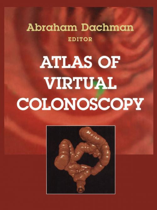 Cover of the book Atlas of Virtual Colonoscopy by , Springer New York