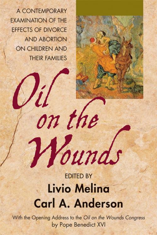 Cover of the book Oil on the Wounds by Father Livio Melina, Carol A. Anderson, Square One Publishers