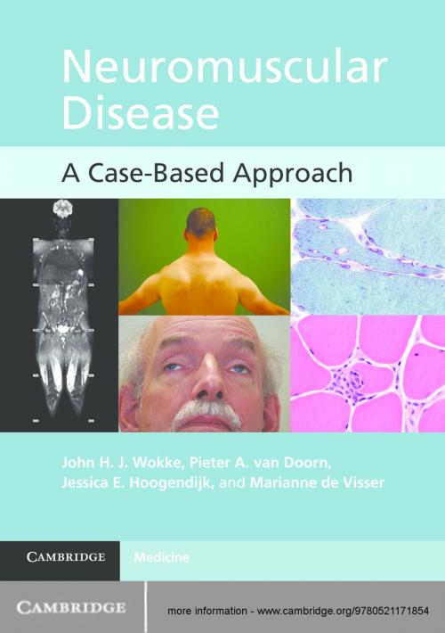 Cover of the book Neuromuscular Disease by John H. J. Wokke, Pieter A. van Doorn, Jessica E. Hoogendijk, Marianne de Visser, Cambridge University Press