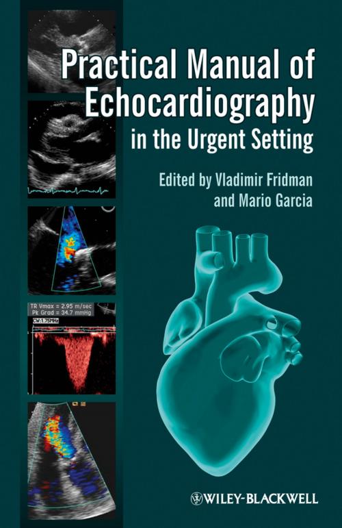 Cover of the book Practical Manual of Echocardiography in the Urgent Setting by , Wiley
