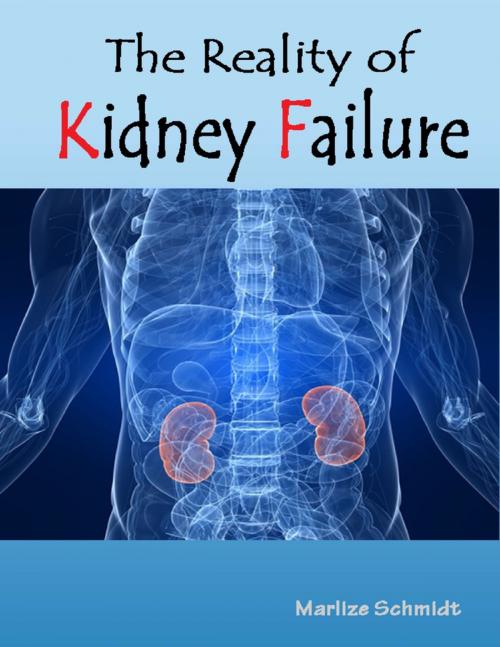 Cover of the book The Reality of Kidney Failure by Marlize Schmidt, Lulu.com