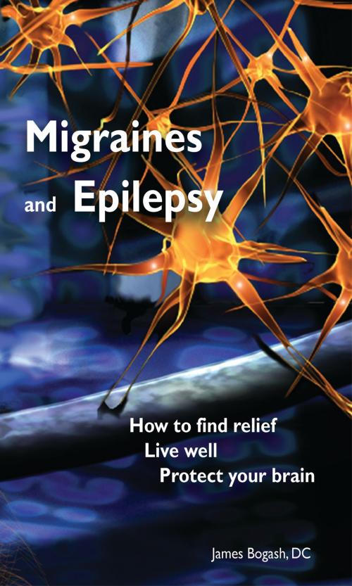 Cover of the book Migraines and Epilepsy: How to Find Relief, Live Well and Protect Your Brain by James Bogash, DC, James Bogash, DC
