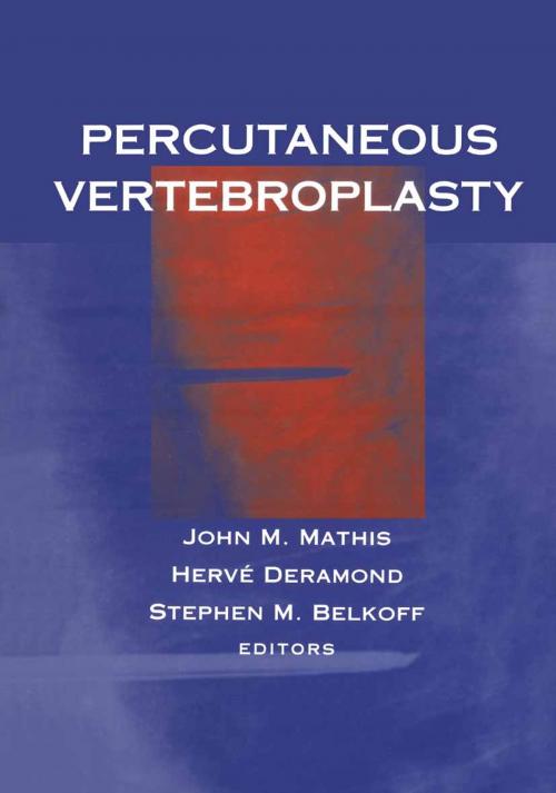Cover of the book Percutaneous Vertebroplasty by , Springer New York