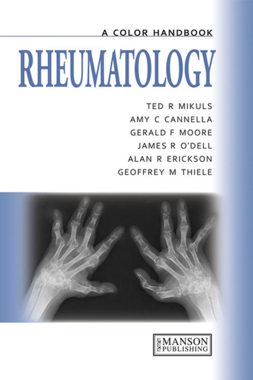 Cover of the book Rheumatology by Amy Cannella, Gerald Moore, Ted Mikuls, James O'Dell, Alan Erikson, Geoffrey Thiele, CRC Press