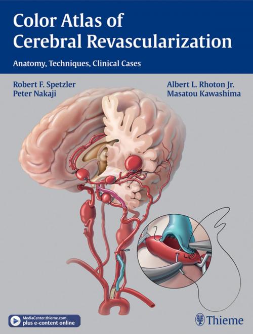 Cover of the book Color Atlas of Cerebral Revascularization by Robert F. Spetzler, Albert L. Rhoton, Peter Nakaji, Thieme