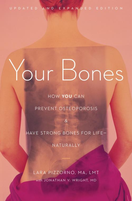Cover of the book Your Bones by Lara Pizzorno, Axios Press