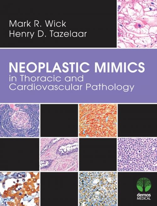 Cover of the book Neoplastic Mimics in Thoracic and Cardiovascular Pathology by Mark R. Wick, MD, Henry D. Tazelaar, MD, Springer Publishing Company