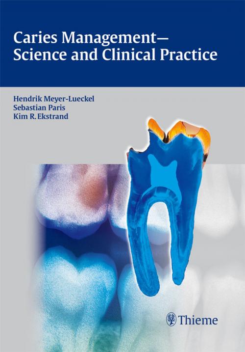 Cover of the book Caries Management - Science and Clinical Practice by , Thieme