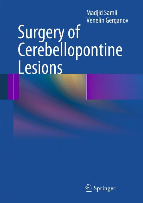Cover of the book Surgery of Cerebellopontine Lesions by Madjid Samii, Venelin Gerganov, Springer Berlin Heidelberg