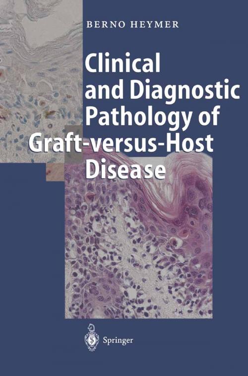 Cover of the book Clinical and Diagnostic Pathology of Graft-versus-Host Disease by D. Bunjes, Berno Heymer, W. Friedrich, Springer Berlin Heidelberg