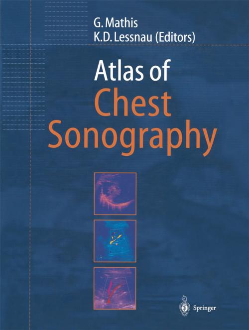 Cover of the book Atlas of Chest Sonography by , Springer Berlin Heidelberg