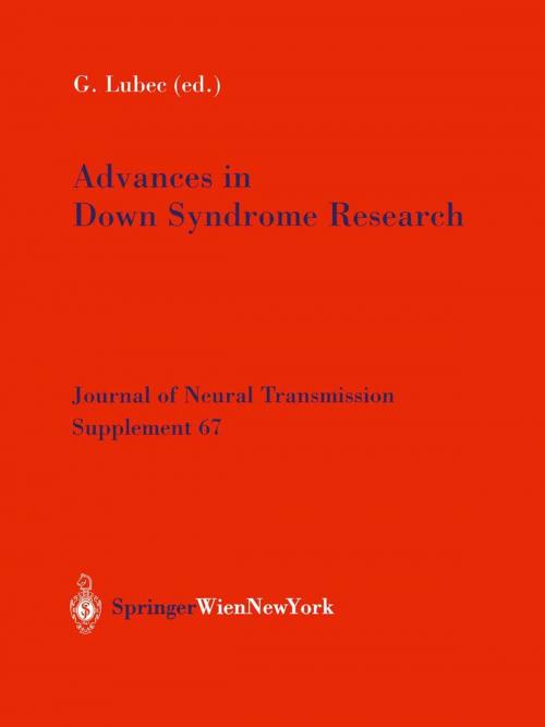 Cover of the book Advances in Down Syndrome Research by , Springer Vienna
