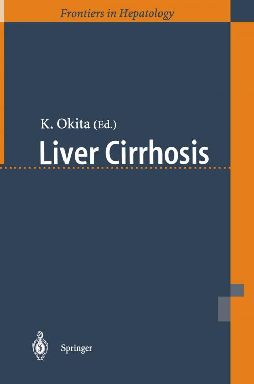 Cover of the book Liver Cirrhosis by , Springer Japan